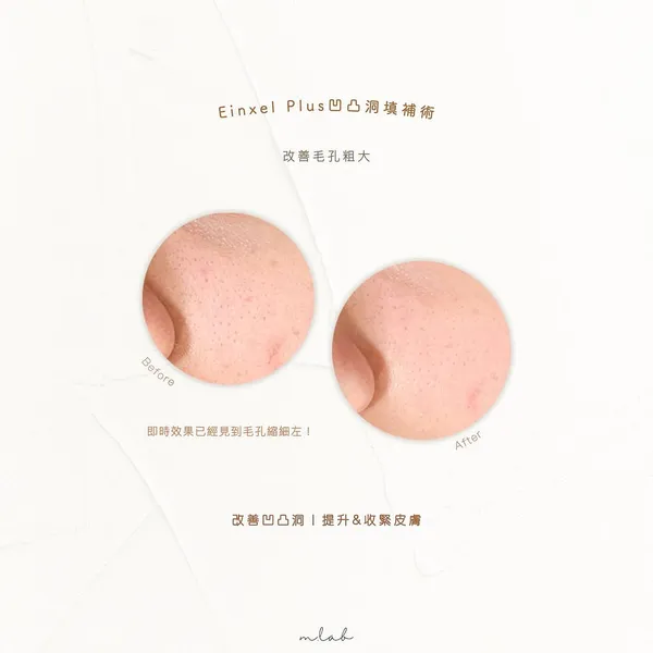 作品展示圖片 2