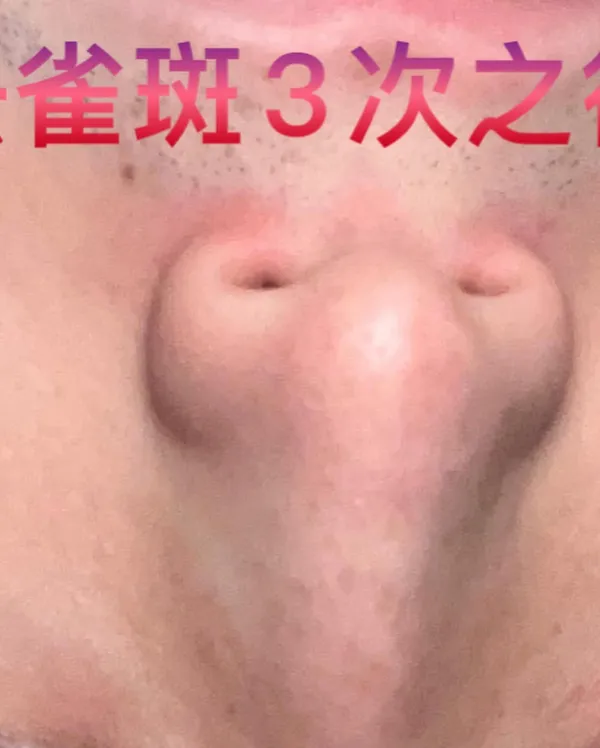 作品展示圖片 3