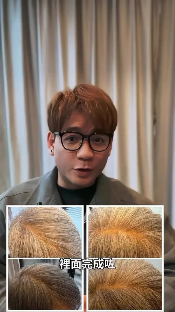 ##HairGrowth ##ScalpCareExpert ##ScalpTreatment 髮型美甲作品