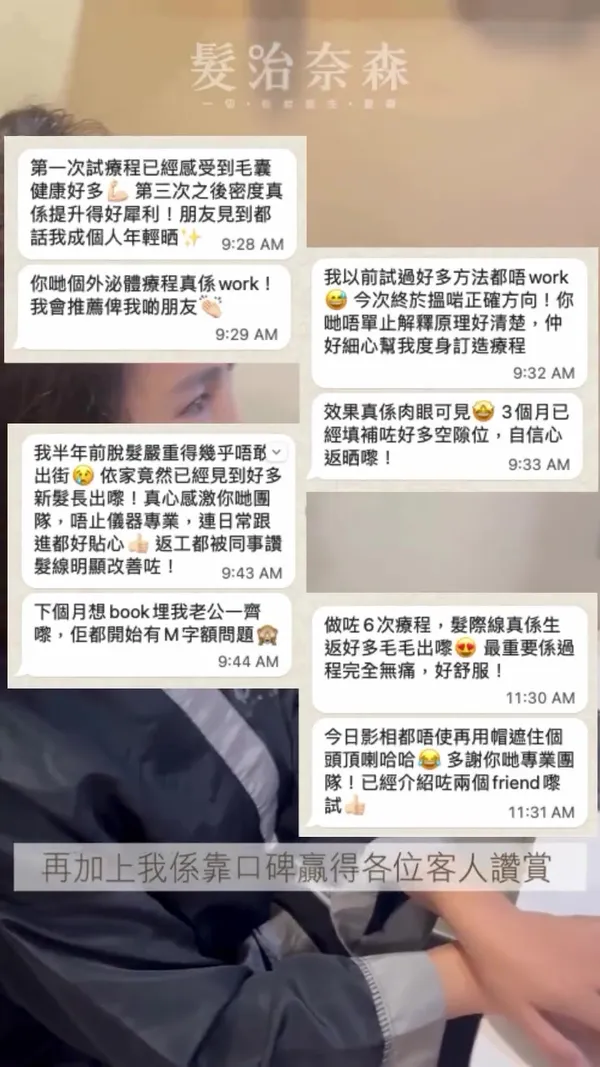 ##外泌體生髮 ##EP爆髮離子槍 ##頭皮護理 髮型美甲作品