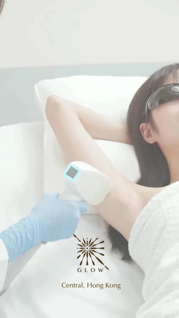 ##GlowHK ##LaserHairRemoval ##LaserHairRemovalTreatment 髮型美甲作品