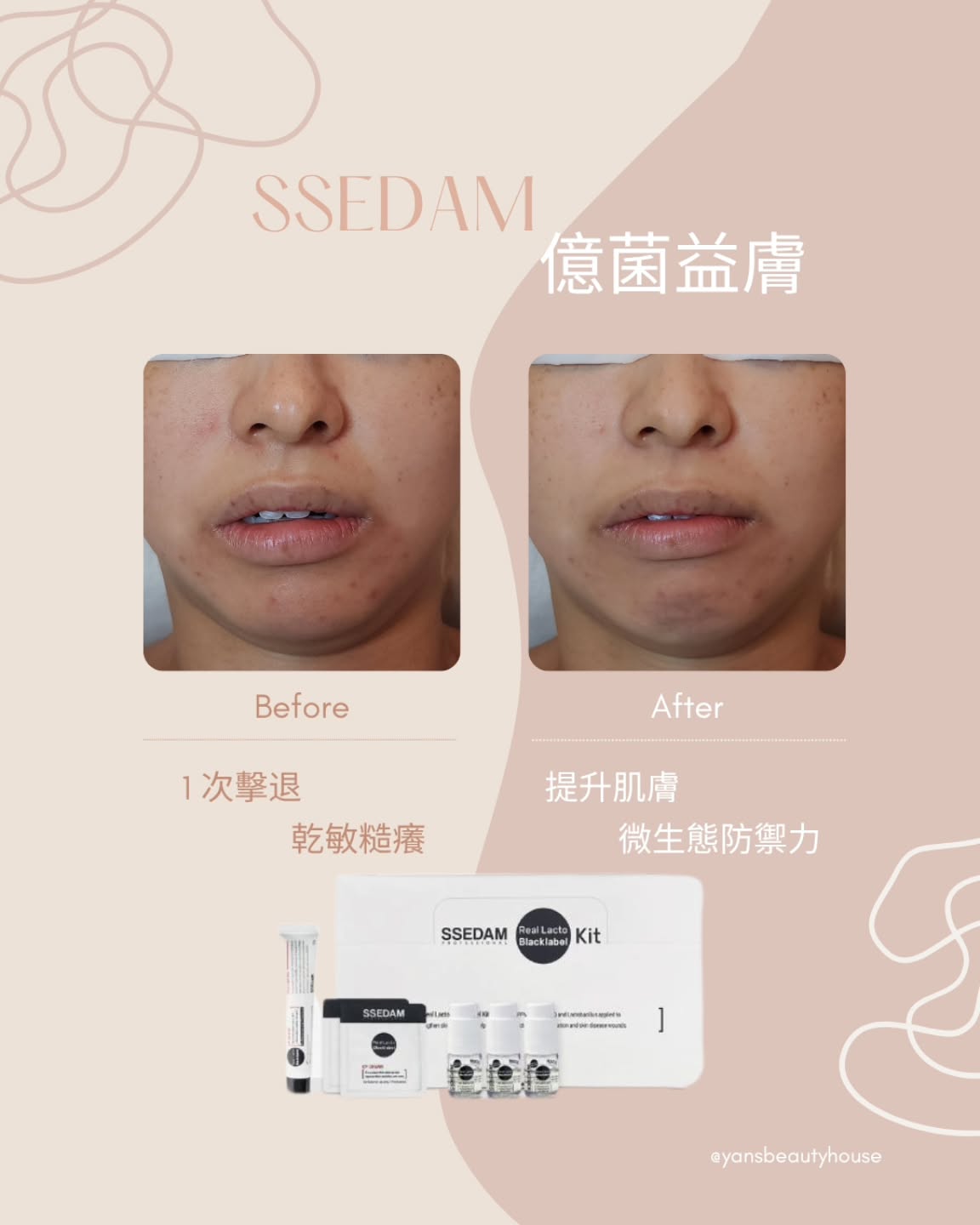 showcase-69e5aba13b7944f540a2cb1c