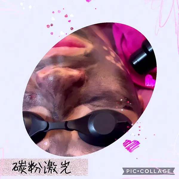 showcase-6a38c44d0f6094eaaaf701f7