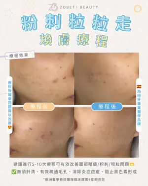 showcase-6a5a27ac93f421fd844d706a
