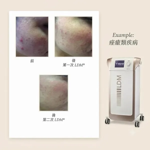 showcase-6a5b11f393f421fd845f0abe