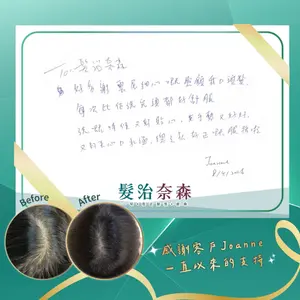 ##髮治奈森 ##真實個案 ##產後脫髮 髮型美甲作品
