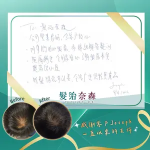 ##髮治奈森 ##真實個案 ##脫髮護理 髮型美甲作品