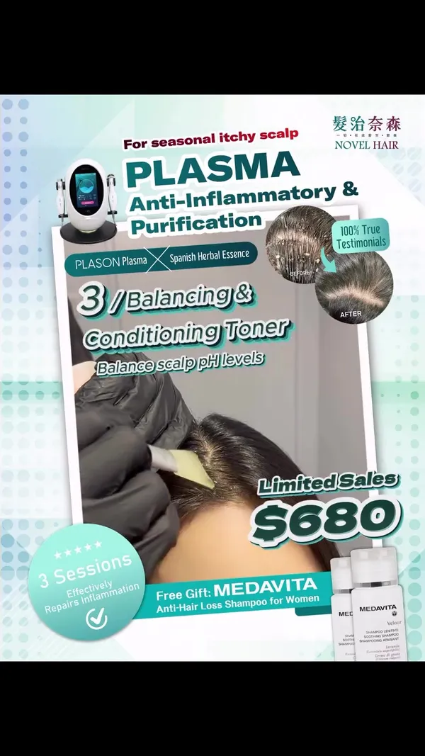 ##ItchyScalp ##ScalpTreatment ##ScalpHealth 髮型美甲作品