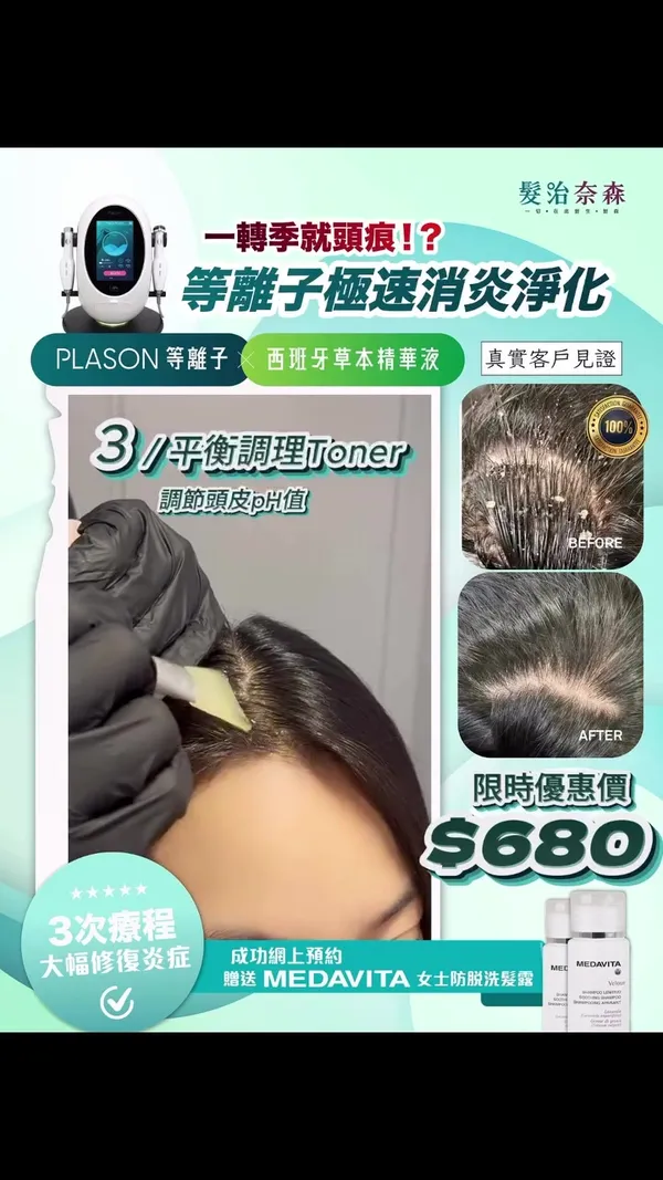 ##ScalpCare ##ScalpInflammation ##HairTreatNelson 髮型美甲作品