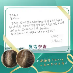 ##HairTreatmentNathan ##ScalpCare ##HairLossSelfHelp 髮型美甲作品