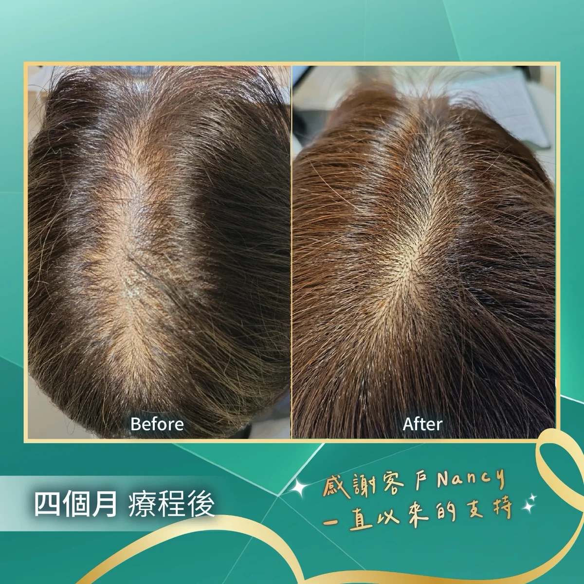 novelhairhk ##HairTreatmentNathan ##ScalpCare ##HairLossSelfHelp 髮型美甲作品 (2)